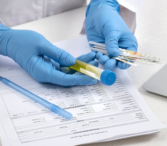 Medical professional handling drug and alcohol testing samples with lab tools.