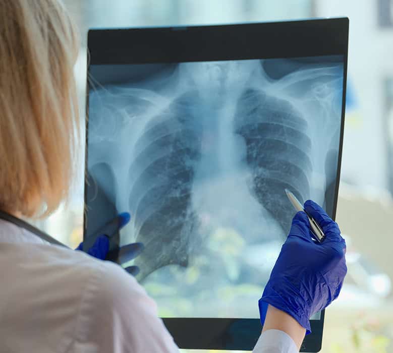 Mobile Chest X-ray for healthcare providers in the UK.