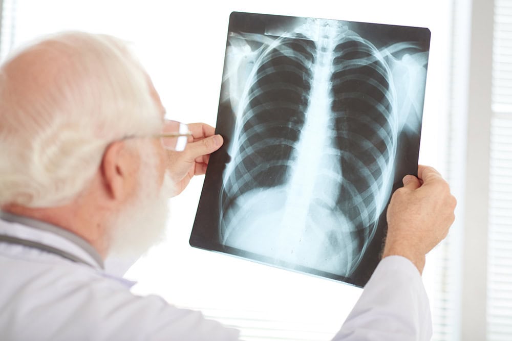 X-ray of a student's chest for medical assessment and health support services.